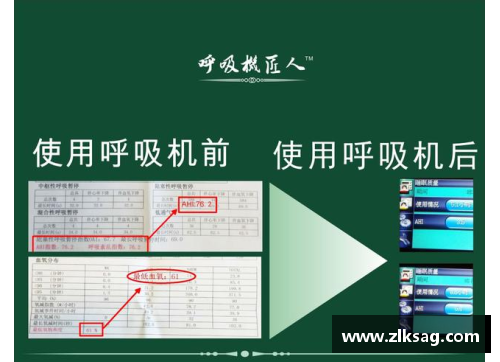 体育明星脑震荡隐患调查：健康风险与保护措施的深度剖析